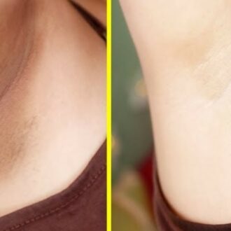 koltuk_alti_beyazlatma