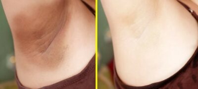 koltuk_alti_beyazlatma